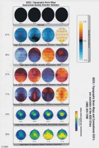 Image of the QEEG Brainmaps