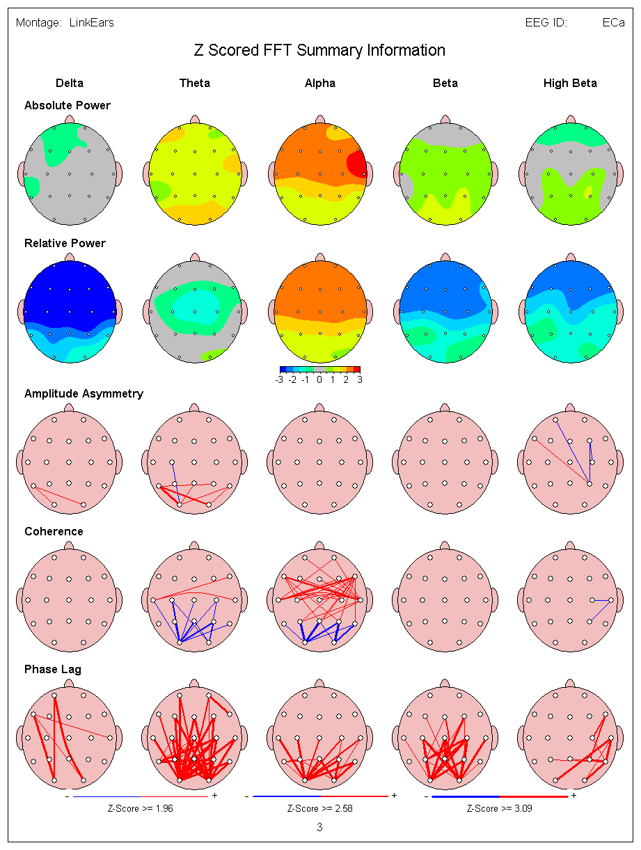 qeeg-brain-mapping-scottsdale-neurofeedback-institute-az