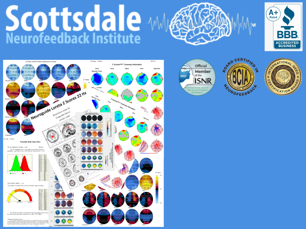 Mappingcollage Scottsdale Neurofeedback Institute Az