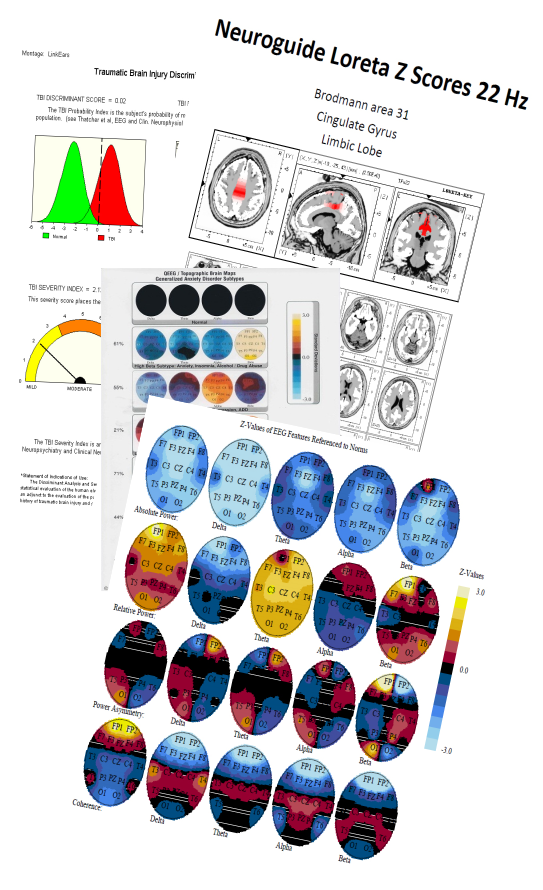 Maps1 Scottsdale Neurofeedback Institute Az